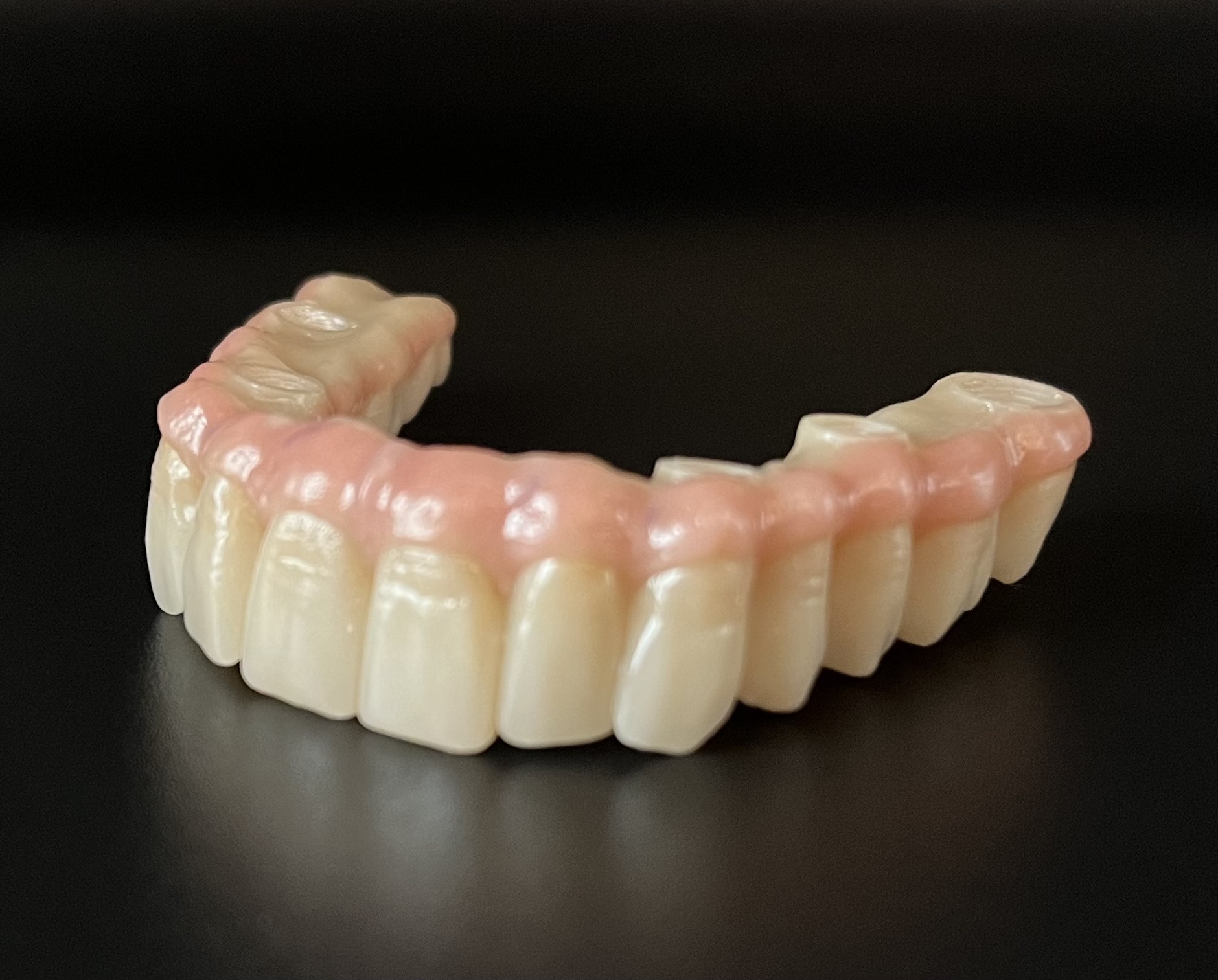 Prothèses dentaires au zirconium Bridge over Custom fraisé